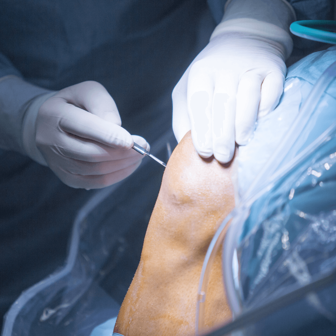 Orthopedics research at Advanced Research